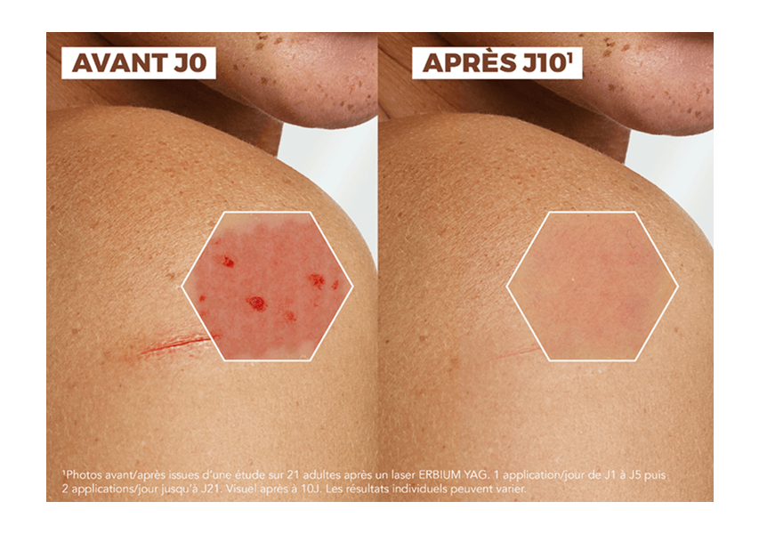 ad_epitheliale_ao_cream-ha+_website_pdp_2025_fr_3282770398632