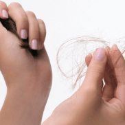 du_anaphase_pathology 2_reactional hair loss_16x9