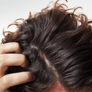 du_kelual ds_original_treatment-shampoo_pathology_4x5