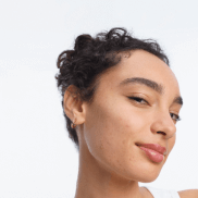 du_keracnyl pp+_anti-blemish cream_skin pathology_full size