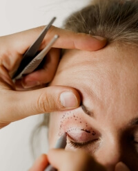 visuel blépharoplastie fiche conseil