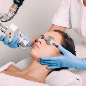 visuel laser fiche conseil