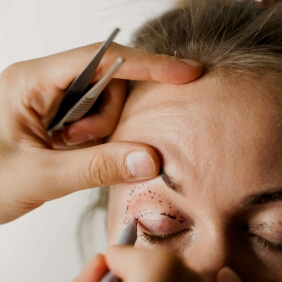 visuel blépharoplastie fiche conseil