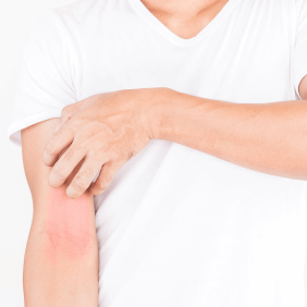 Comment prendre soin de sa peau atopique au quotidien ?