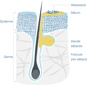 Croutes de lait - 01