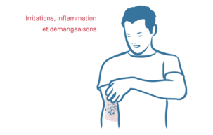 Eczéma Atopique - 03