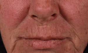 Résultat Anti-âge serum photo 1 (1)