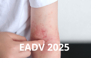 Card DA EADV def