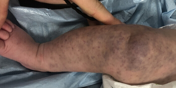 leg