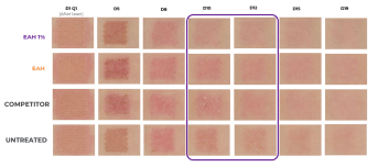 Etude clinique epitheliale imagerie classique.png