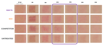 Etude clinique epitheliale imagerie classique.png