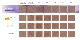IMAGERIE 3D etude clinique.png