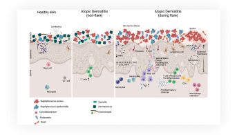 Le microbiome cutané