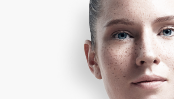 Visage