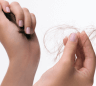 du_anaphase_pathology 2_reactional hair loss_16x9